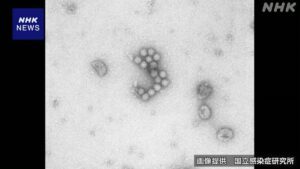 Số ca nhiễm norovirus cao kỷ lục tại Nhật