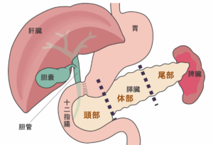 ĐH Kyoto phát hiện cơ chế khiến ung thư tụy di căn