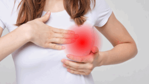 Người ung thư vú dễ mắc suy tim và gãy xương